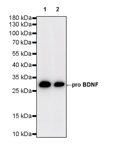 BDNF Recombinant Rabbit mAb (S-4118-38)