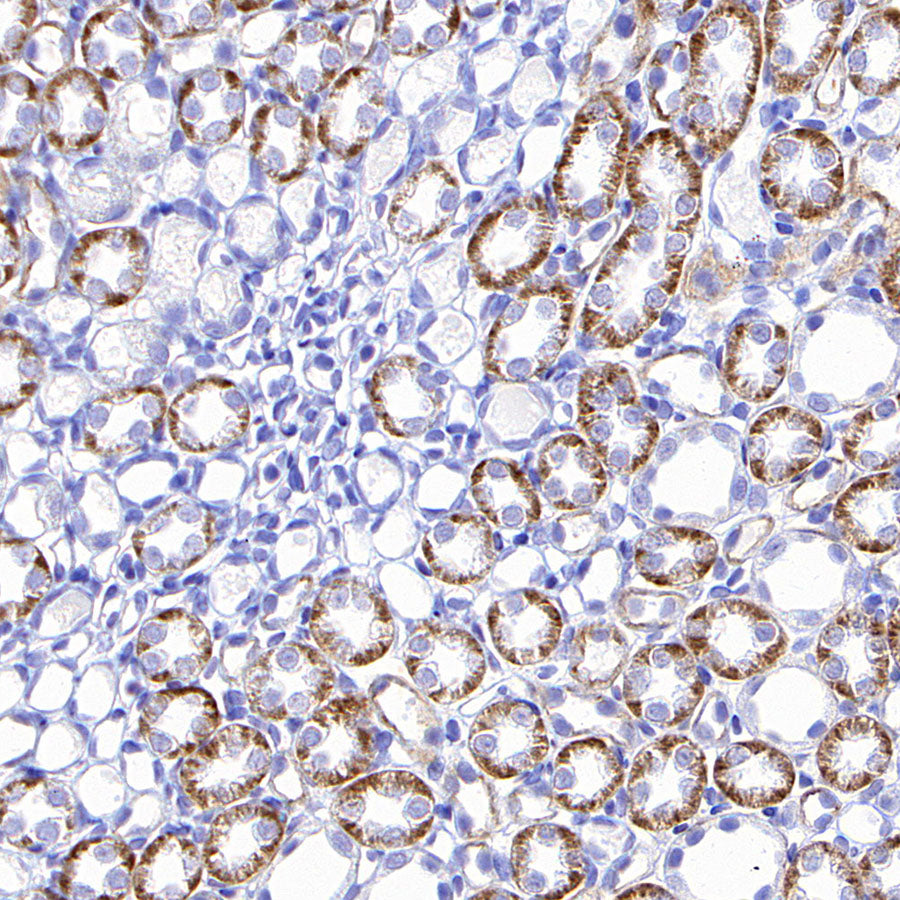 SLC5A1/SGLT1 Recombinant Rabbit mAb (S-4122-30)