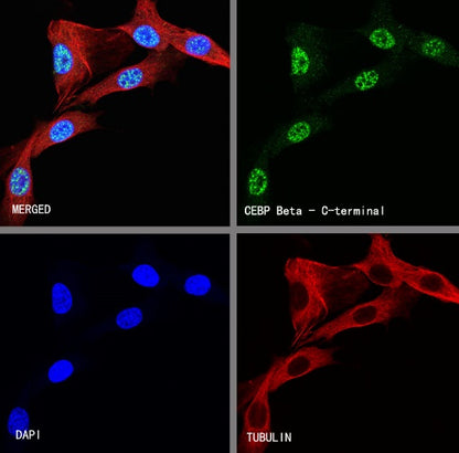 CEBP Beta (C-terminal) Recombinant Rabbit mAb (S-773-48)