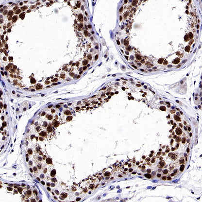 ALKBH5 Recombinant Rabbit mAb (S-2264-39)