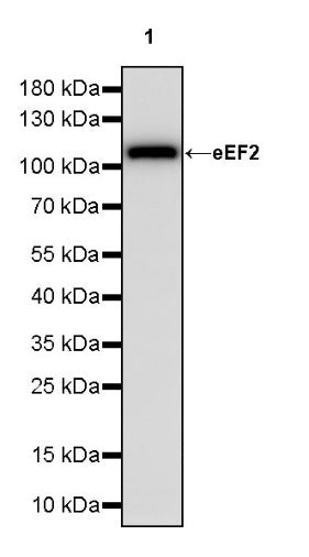 eEF2 Recombinant Rabbit mAb (S-1976-35)