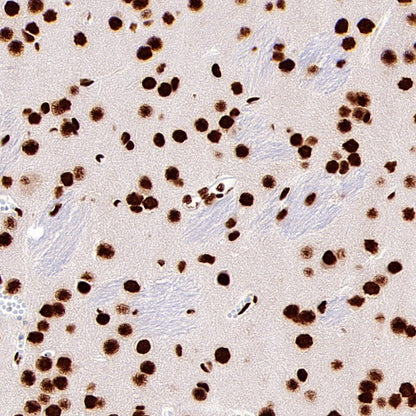 ARID1A Recombinant Rabbit mAb (S-440-27)
