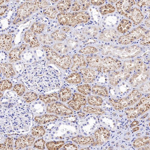 Cathepsin B Recombinant Rabbit mAb (S-1067-7)
