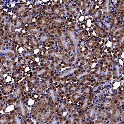 FTO Recombinant Rabbit mAb (S-1663-48)