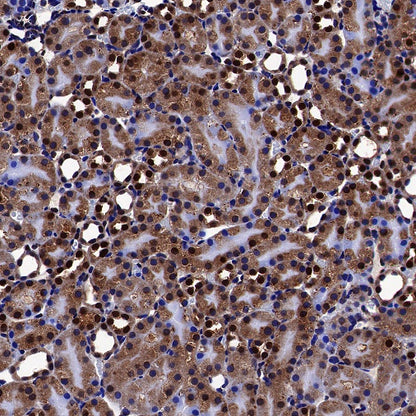 FTO Recombinant Rabbit mAb (S-1663-48)