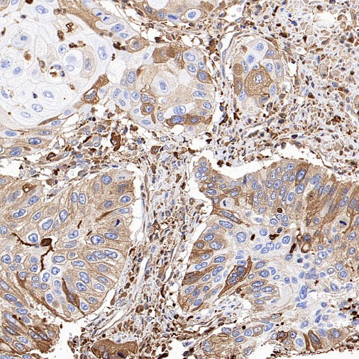 Ferritin Light Chain Recombinant Rabbit mAb (S-1879-19)