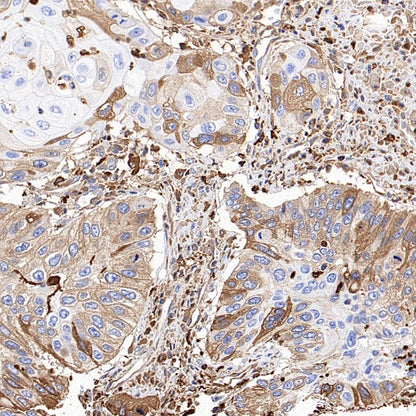 Ferritin Light Chain Recombinant Rabbit mAb (S-1879-19)