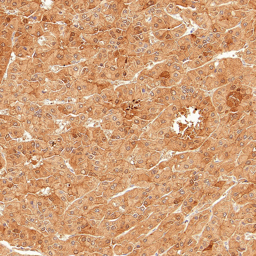 AK1C3 Rabbit Polyclonal Antibody