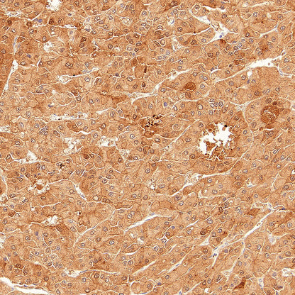 AK1C3 Rabbit Polyclonal Antibody