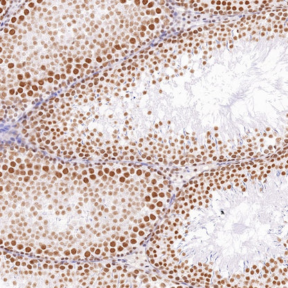 Cyclin K Recombinant Rabbit mAb (S-1586-18)