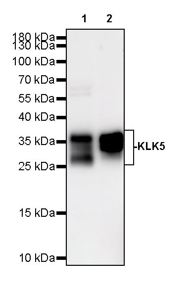 KLK5 Recombinant Rabbit mAb (S-4238-55)