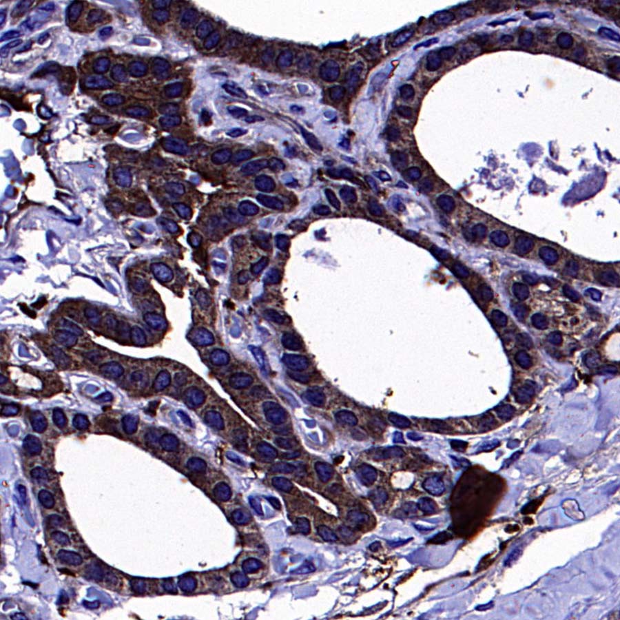 BIN1 Recombinant Rabbit mAb (S-4287-18)