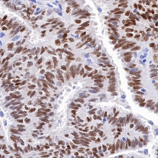 Estrogen Receptor α Recombinant Rabbit mAb (SDT-R371)