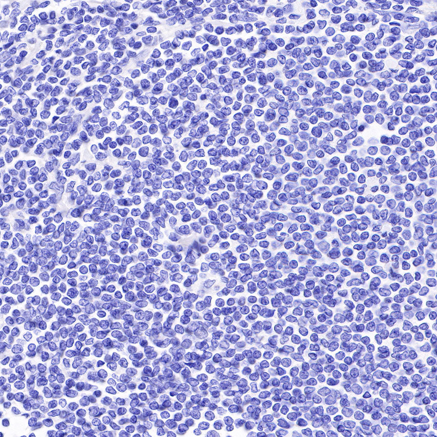 CD30 Recombinant Rabbit mAb (SDT-216-2)