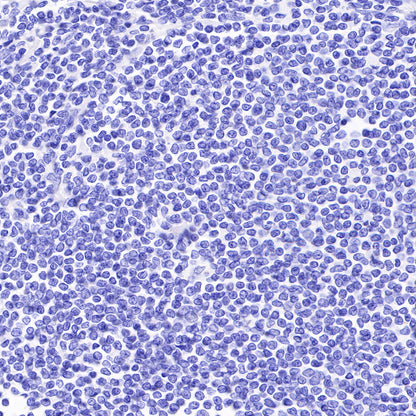 CD30 Recombinant Rabbit mAb (SDT-216-2)
