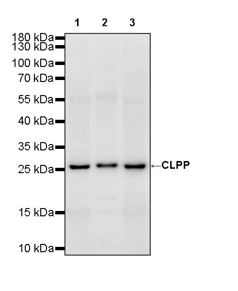 CLPP Recombinant Rabbit mAb (S-4169-31)