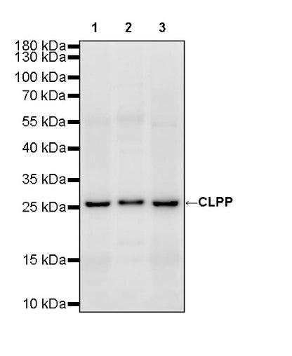 CLPP Recombinant Rabbit mAb (S-4169-31)