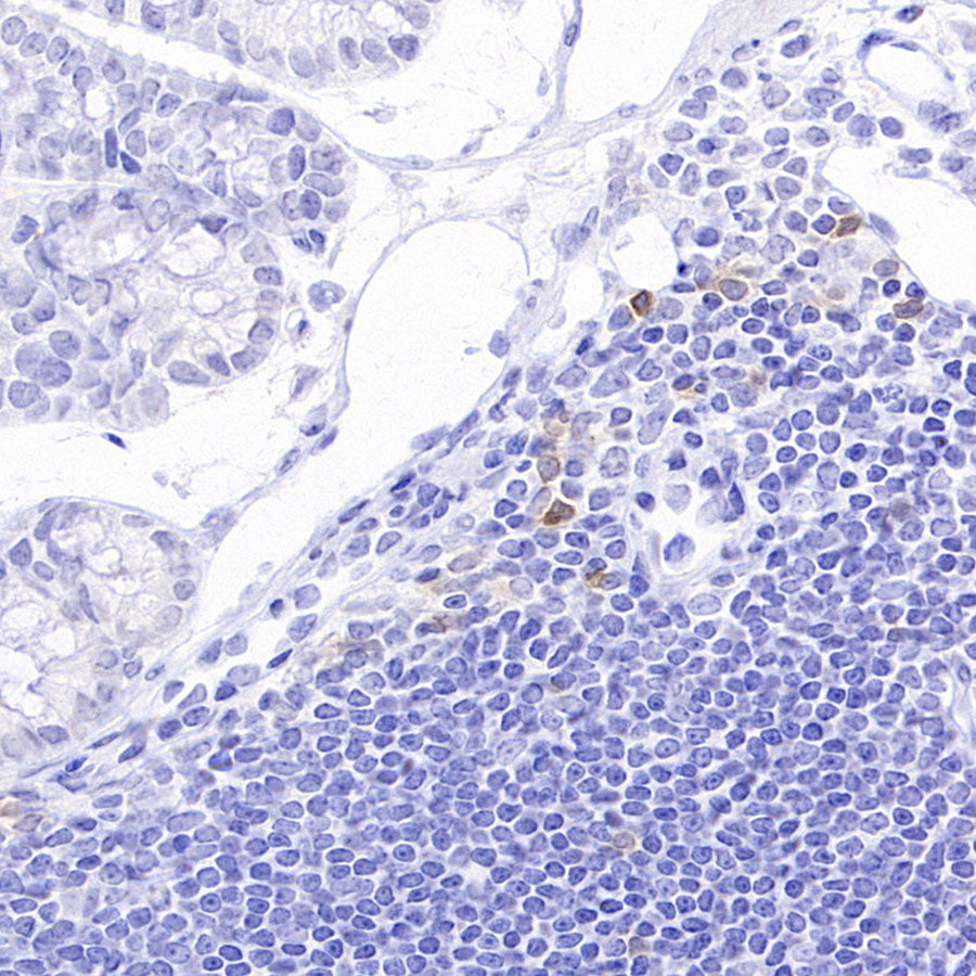 NKR-P1C Recombinant Rabbit mAb (S-4706)