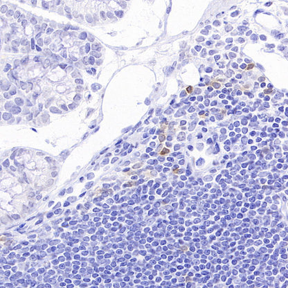 NKR-P1C Recombinant Rabbit mAb (S-4706)