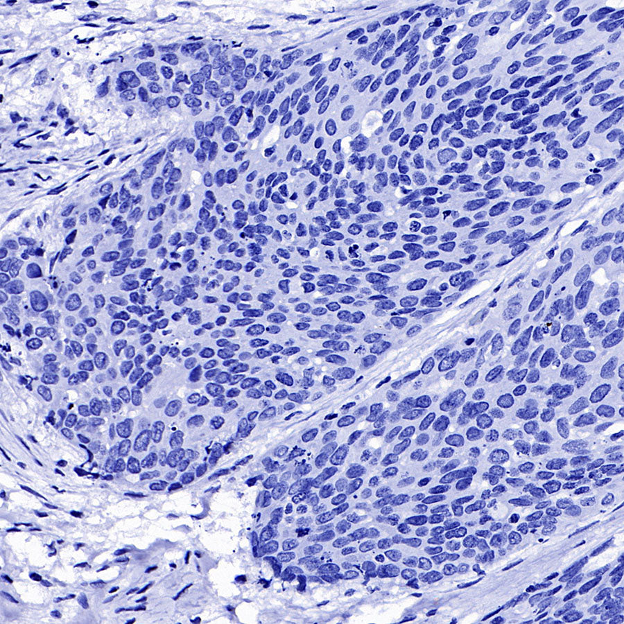 TSH Receptor/TSH-R Recombinant Rabbit mAb (S-5699)