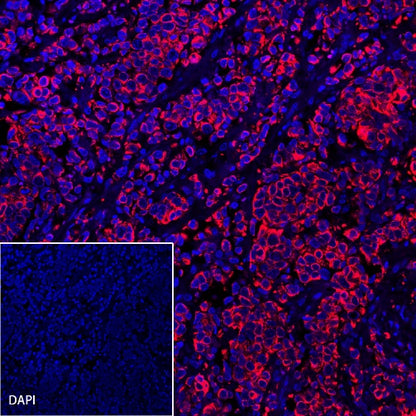 CK-Pan Recombinant Rabbit mAb (Alexa Fluor® 594 Conjugate) (S-P001)