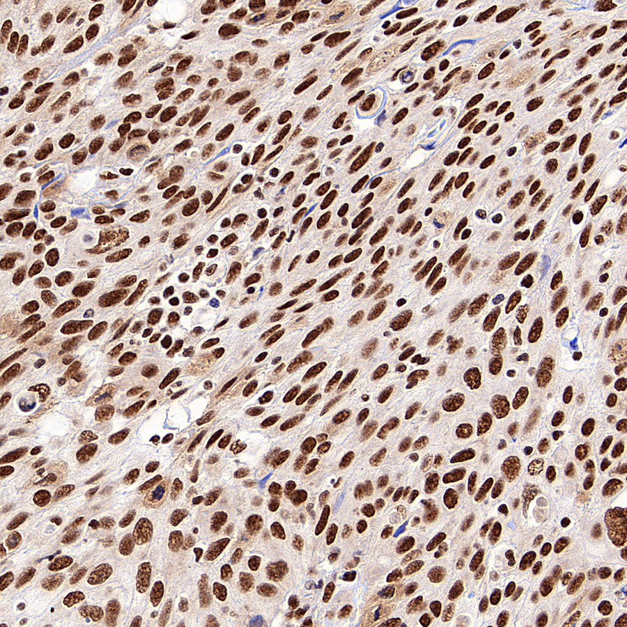 SF3B1 Rabbit Polyclonal Antibody