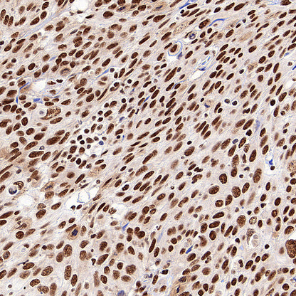 SF3B1 Rabbit Polyclonal Antibody