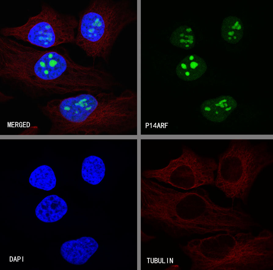 p14ARF Recombinant Rabbit mAb (S-R244)