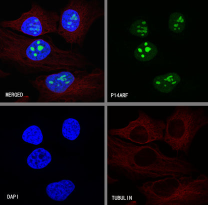 p14ARF Recombinant Rabbit mAb (S-R244)