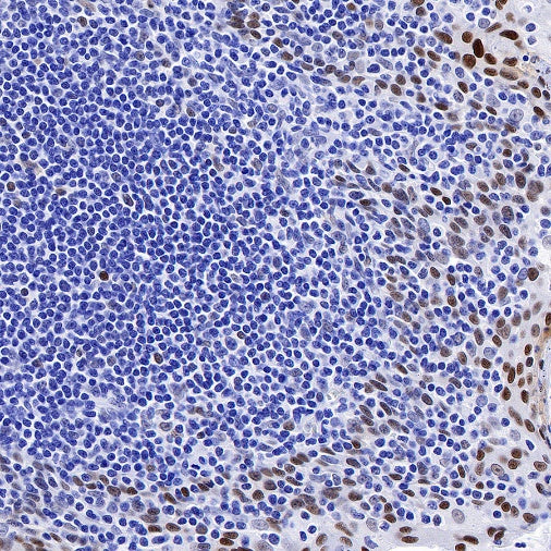 JunB Recombinant Rabbit mAb (S-670-242)