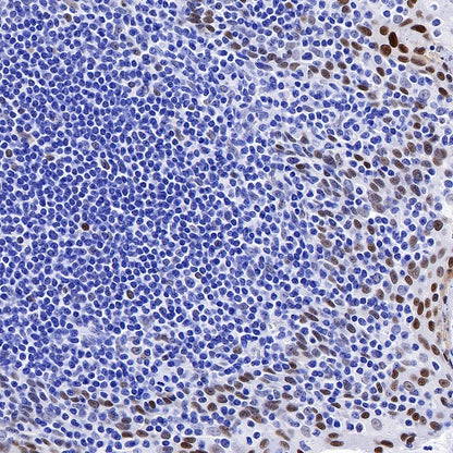 JunB Recombinant Rabbit mAb (S-670-242)