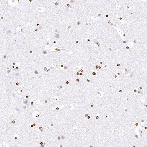 Histone H3 (acetyl K4) Recombinant Rabbit mAb (S-848-137)