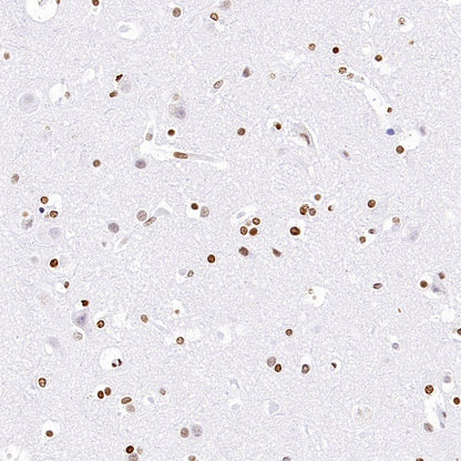 Histone H3 (acetyl K4) Recombinant Rabbit mAb (S-848-137)