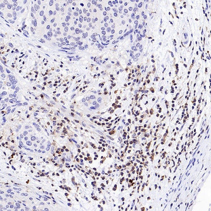 NFAT2 Recombinant Mouse mAb (S-4705)