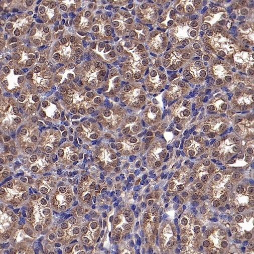 Park7/DJ-1 Recombinant Rabbit mAb (S-980-144)