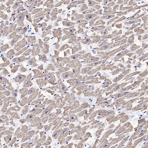 Myosin light chain 3 Recombinant Rabbit mAb (S-664-75)