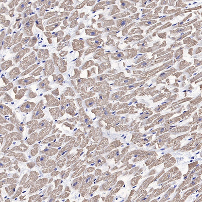 Myosin light chain 3 Recombinant Rabbit mAb (S-664-75)