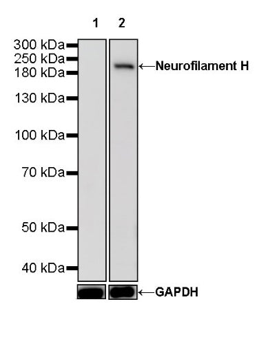 Neurofilament H Recombinant Rabbit mAb (S-532-103)