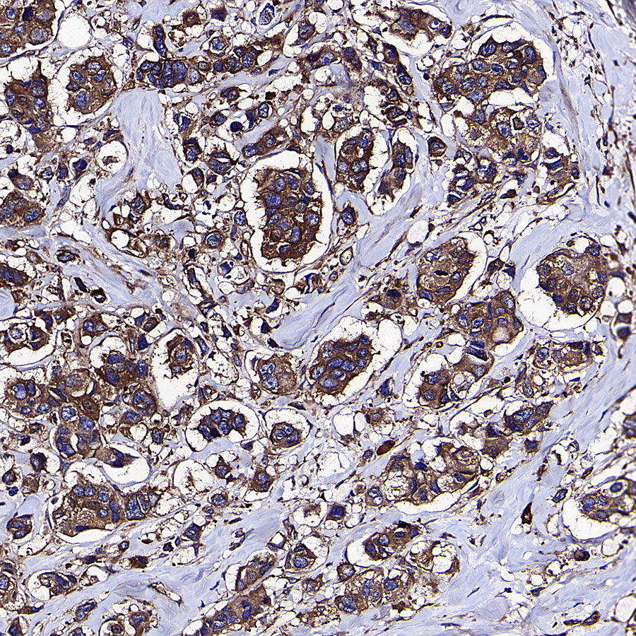KLC1 Recombinant Rabbit mAb (S-4556-17)