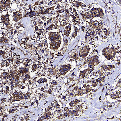 KLC1 Recombinant Rabbit mAb (S-4556-17)