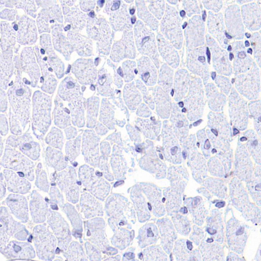 HER2/ErbB2 Recombinant Rabbit mAb (S-3935-58)