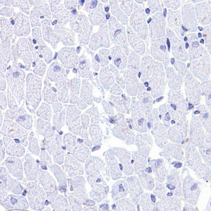 HER2/ErbB2 Recombinant Rabbit mAb (S-3935-58)