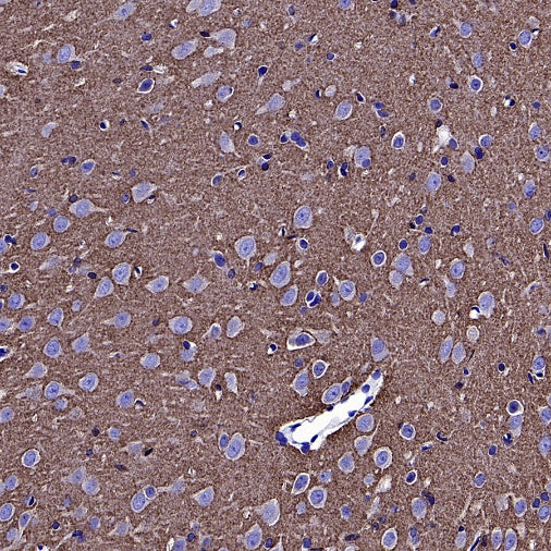 VAMP2 Recombinant Rabbit mAb (S-2359-2)