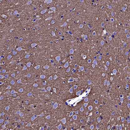 VAMP2 Recombinant Rabbit mAb (S-2359-2)