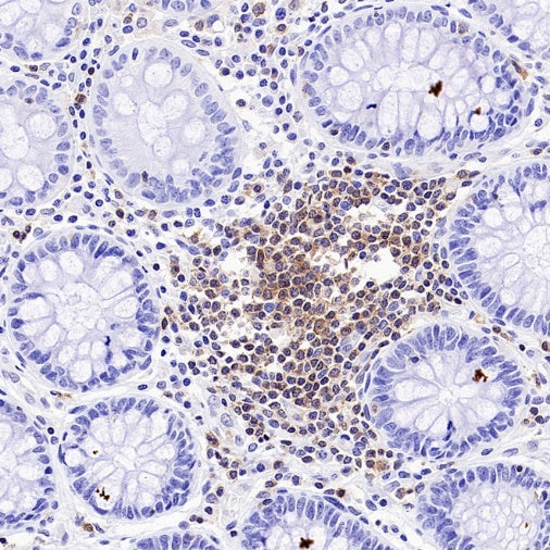 NFAT2 Recombinant Mouse mAb (S-4705)