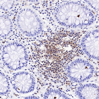NFAT2 Recombinant Mouse mAb (S-4705)