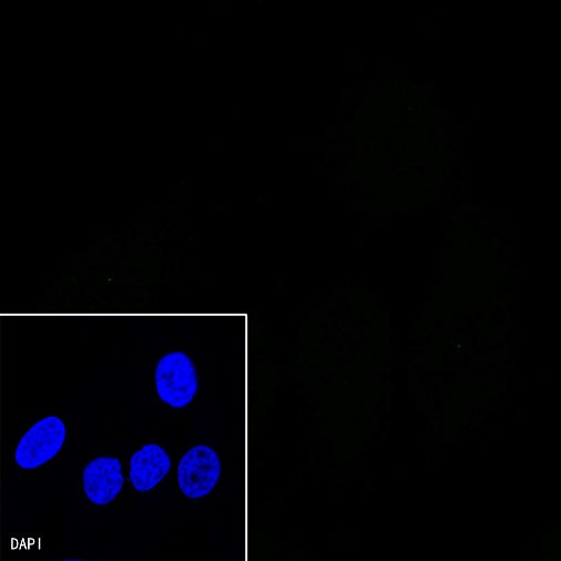 S-RMab® SOX10 Recombinant Rabbit mAb (SDT-R233)
