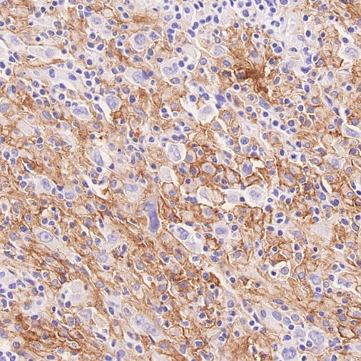 LILRB4 Recombinant Rabbit mAb (S-2504-22)