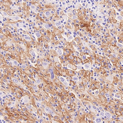LILRB4 Recombinant Rabbit mAb (S-2504-22)