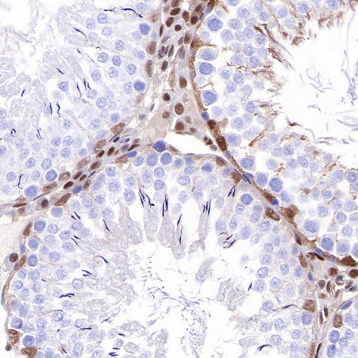 p27 Recombinant Rabbit mAb (SDT-R350)